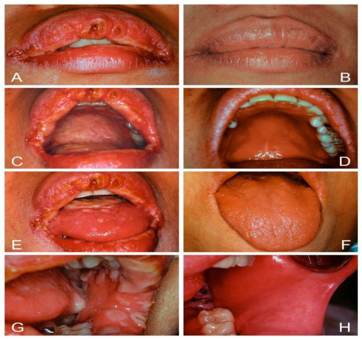 Figure 6