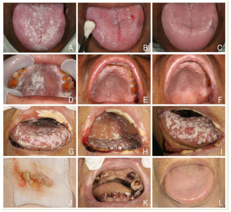 Figure 10