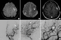 Figure 17.