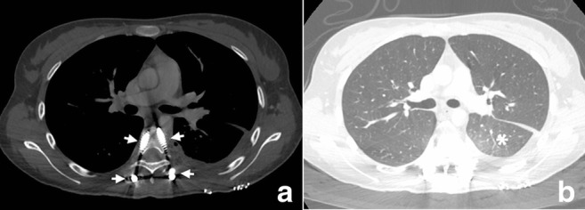 Fig. 9