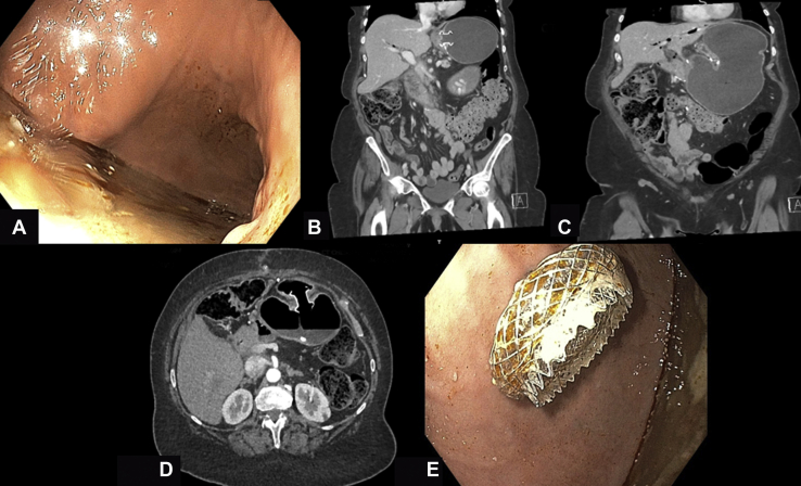 Figure 2