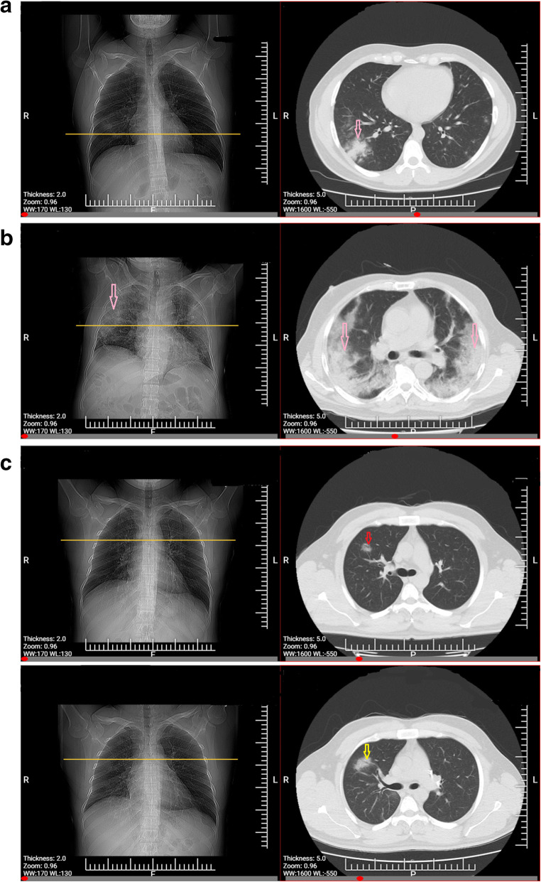 Fig. 1