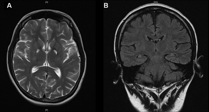 Figure 2