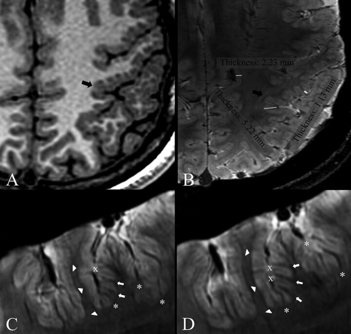 Fig 2.