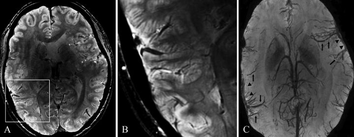 Fig 3.