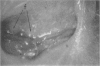 82