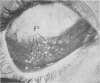 79