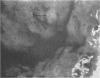 83