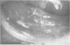 80