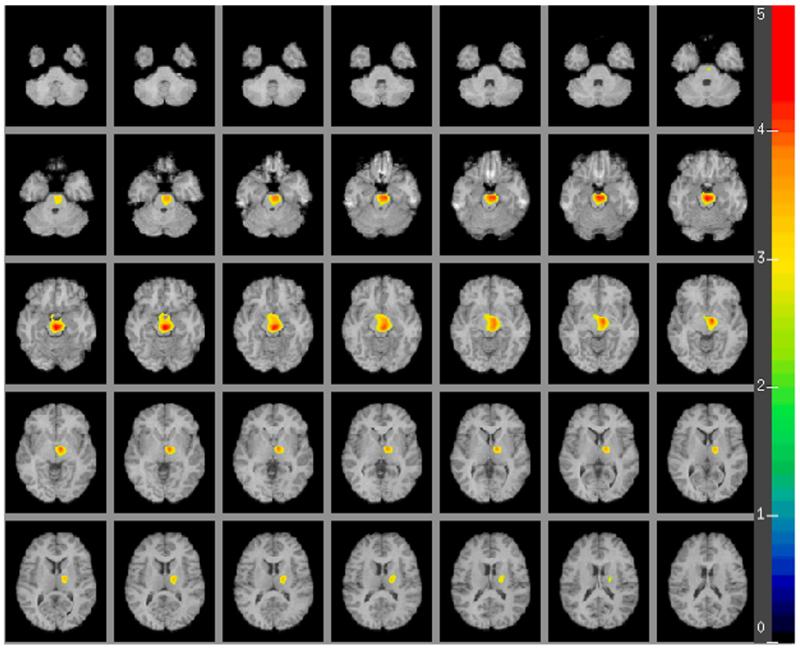 Fig. 2