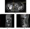 Fig. 2