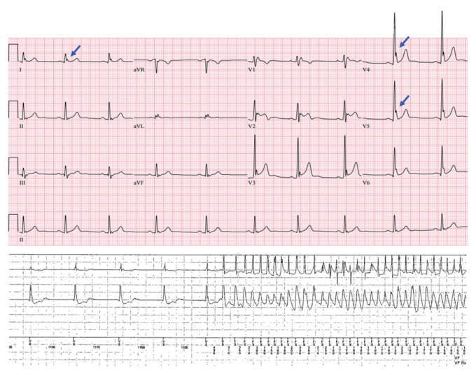 Figure 4