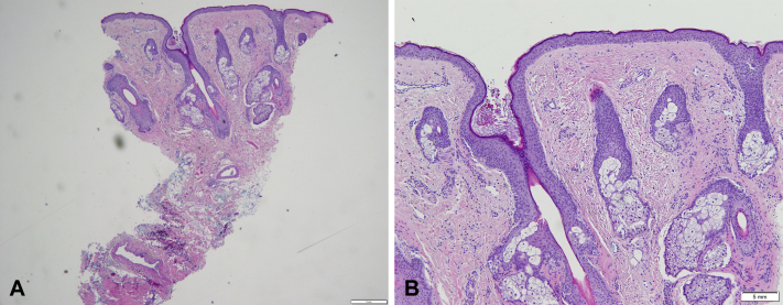 Fig 2