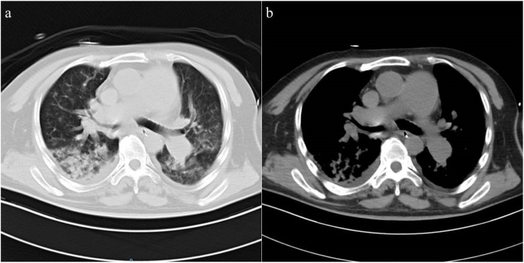 Fig. 5