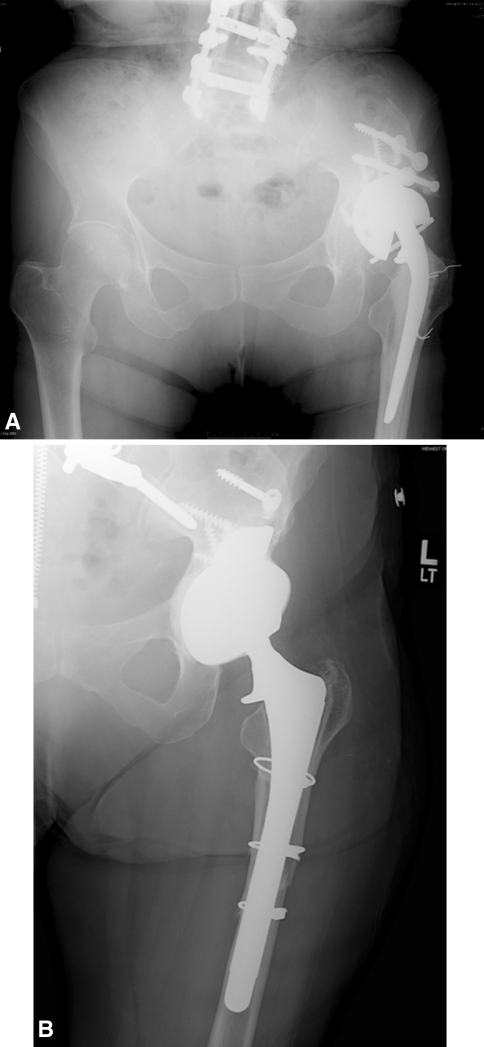 Fig. 1A–B