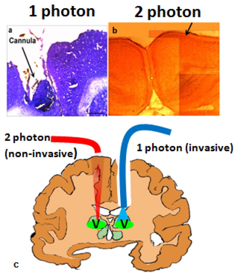 Figure 14