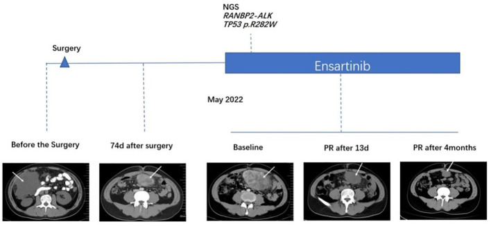 Figure 1