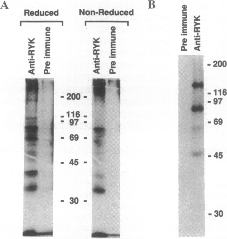 graphic file with name pnas01098-0183-a.jpg