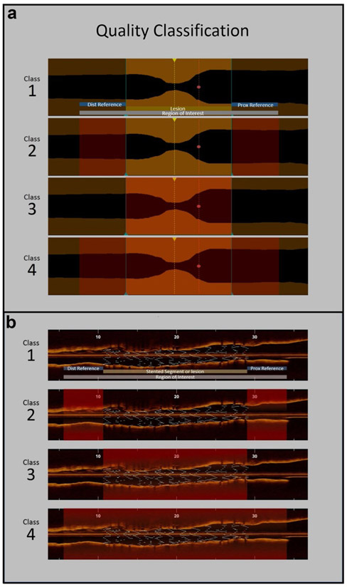 Fig.1