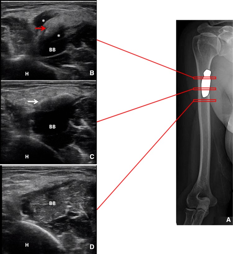 Fig. 2