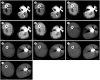 Fig. 12