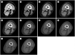 Fig. 11