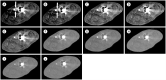 Fig. 14
