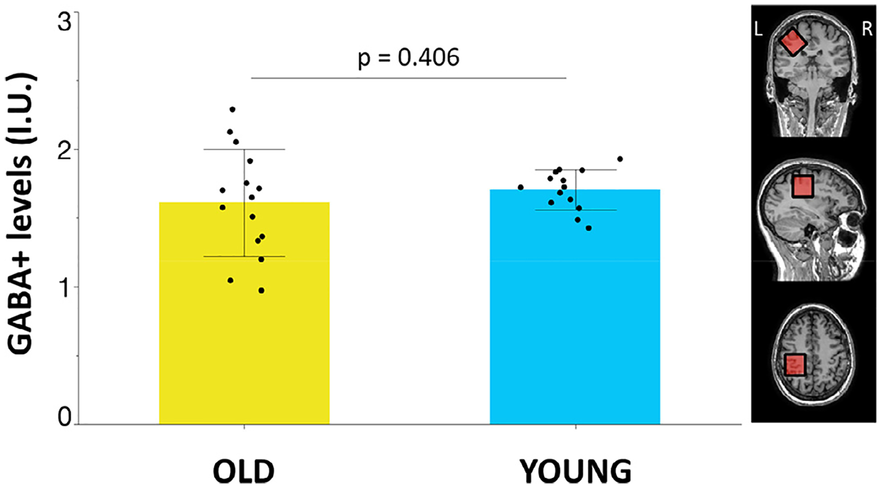 Fig. 3.