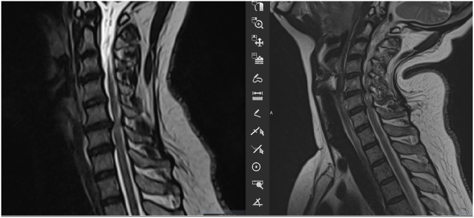 Fig. 11