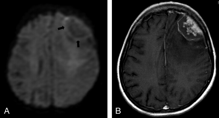 Fig 2.