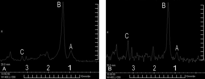 Fig 3.