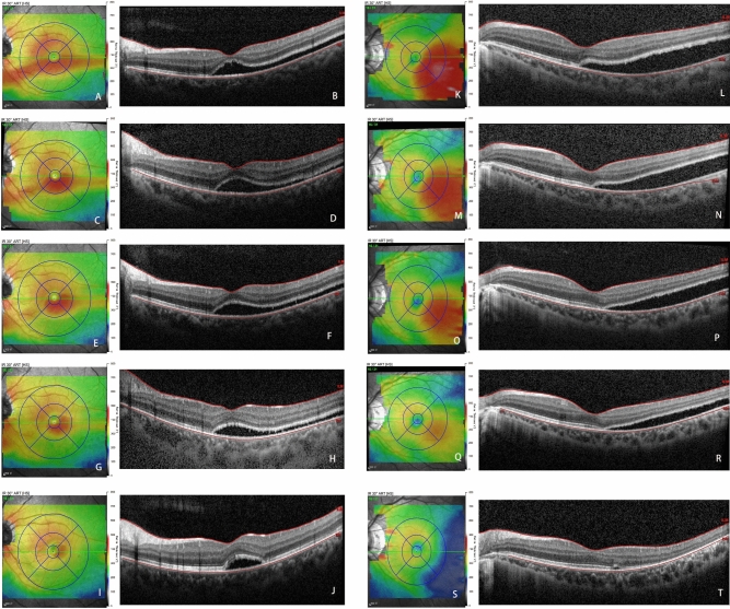 Fig. 3