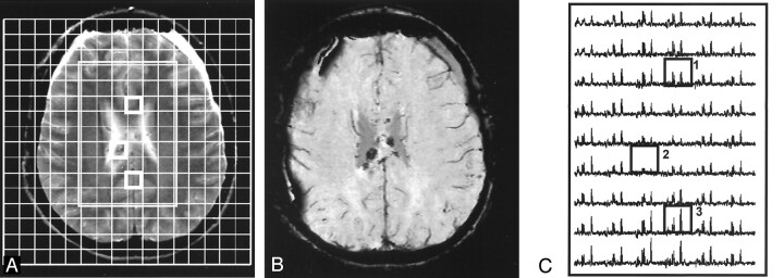 Fig 4.