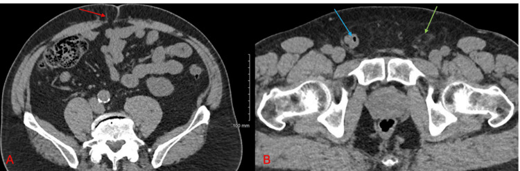 Figure 5