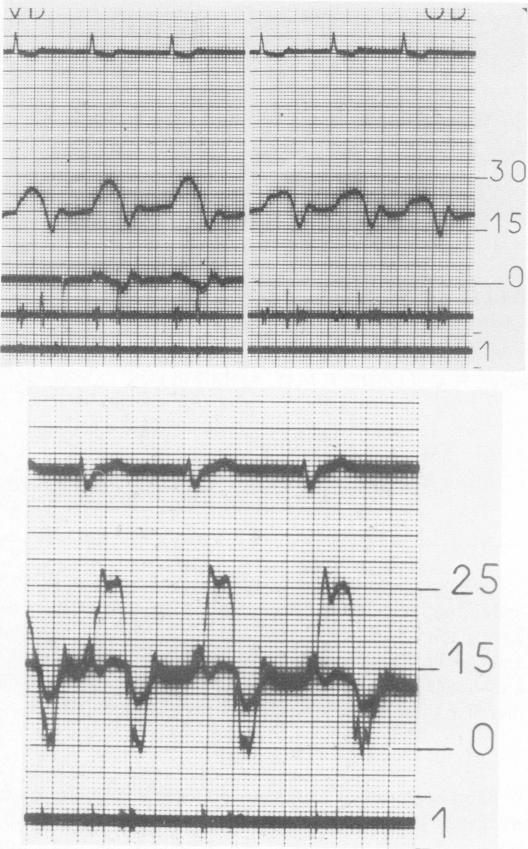 Figs. 1a and b.