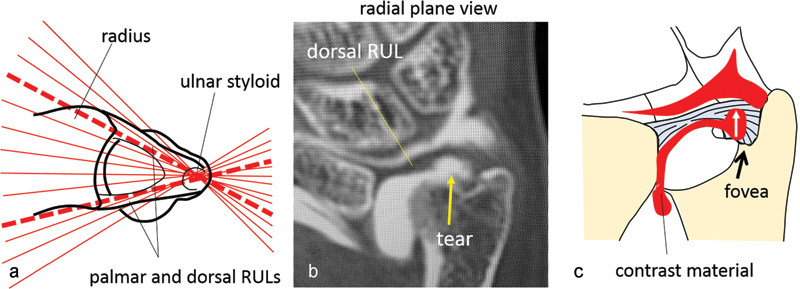 Fig. 4a–c