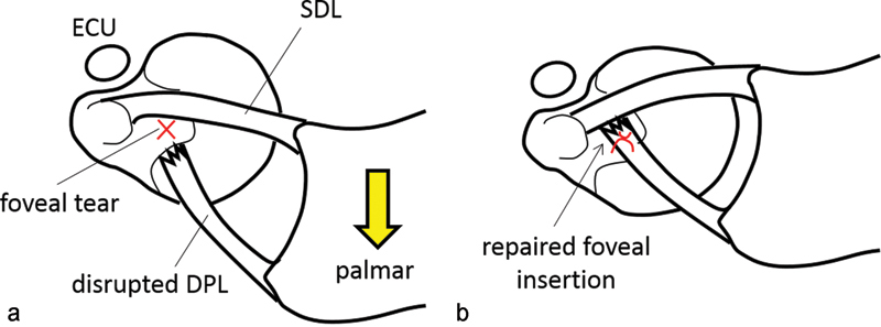 Fig. 2a, b