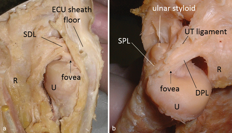 Fig. 3a, b