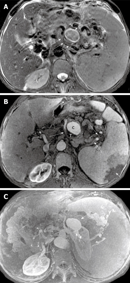 Figure 18