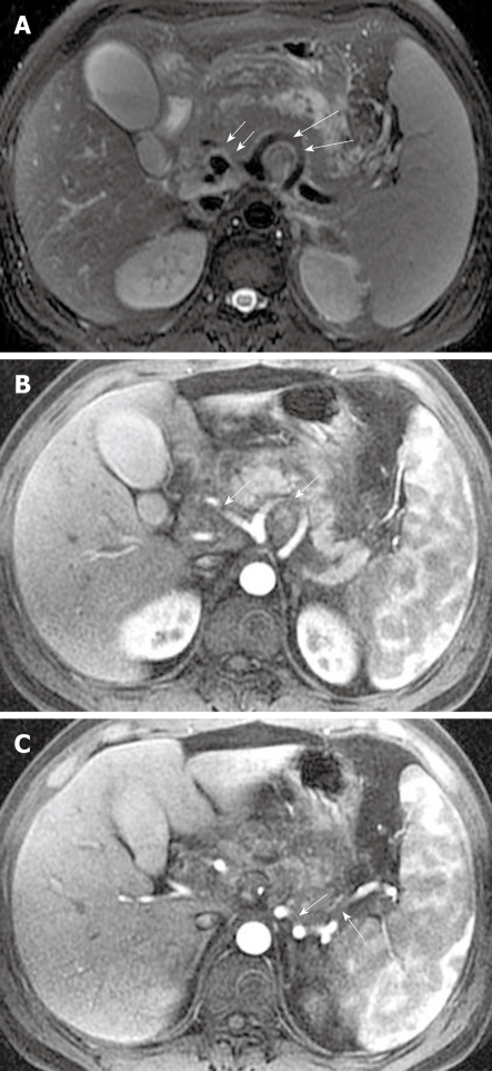 Figure 17