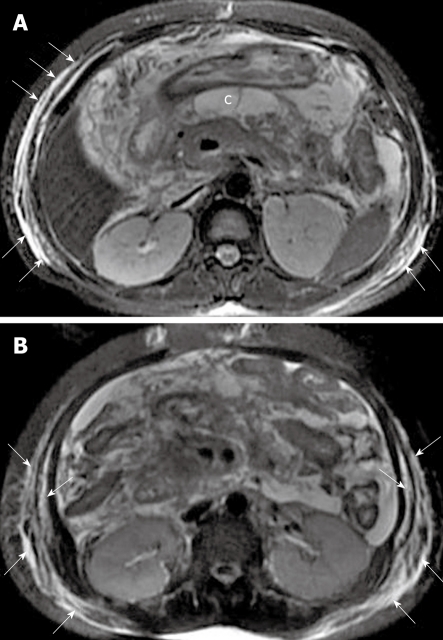 Figure 21