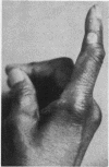 93