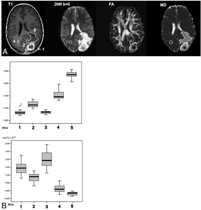 Fig 4.