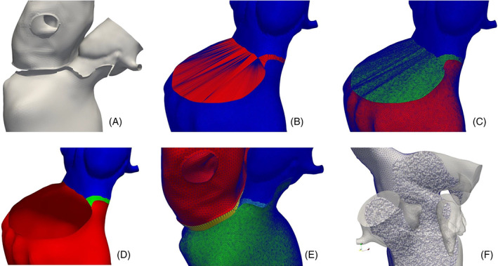 FIGURE 16