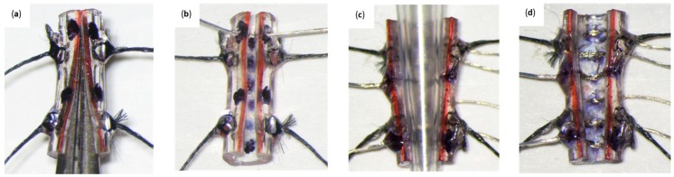 Figure 14