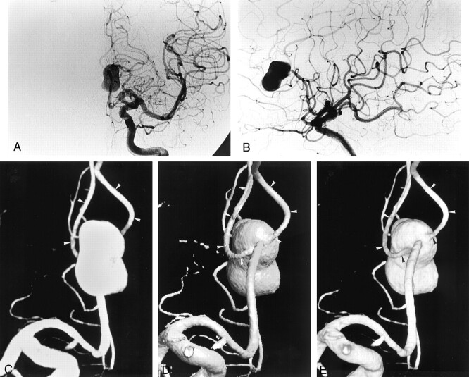 Fig 2.