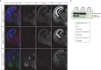 Figure 1—figure supplement 2.
