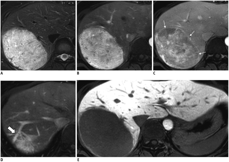 Fig. 15