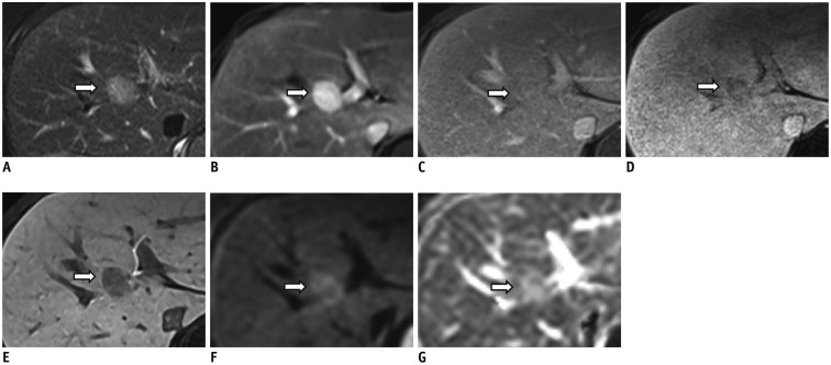 Fig. 12