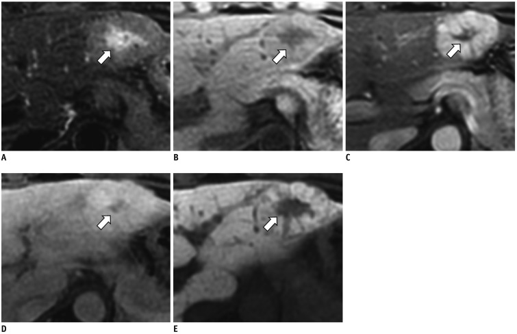 Fig. 14